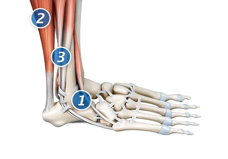 Graphic of the bones, joints, ligaments and connective tissue of the foot, ankle and lower leg Graphic of the bones, joints, ligaments and connective tissue of the foot, ankle and lower leg